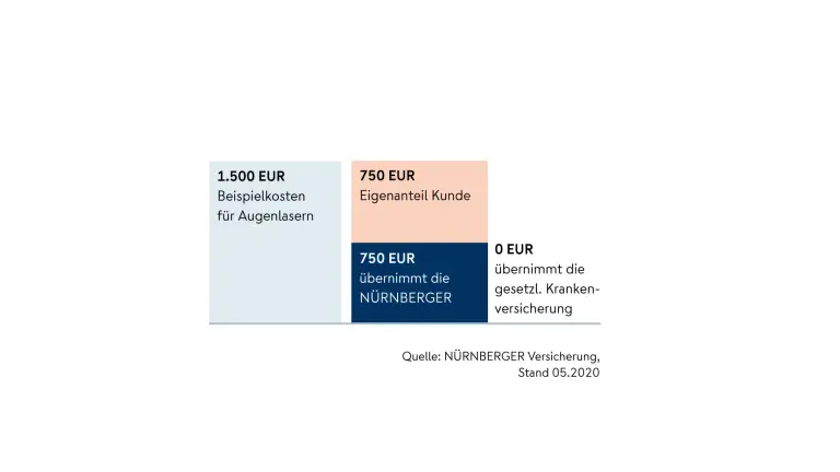 Grafik Beispielrechnung Augenlasern