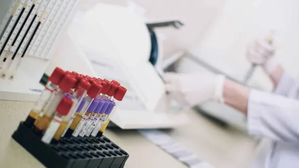 Laborantin untersucht Blutproben im Labor