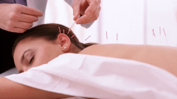 Frau liegt auf Bauch mit geschlossenen Augen und bekommt Akupunktur-Nadeln in Rücken und Ohr